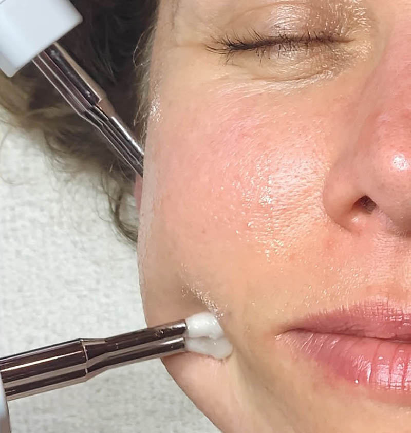 Microcurrent facial